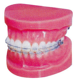 Normal Fixed Orthodontic Model for Hospitals And Medical Schools Training
